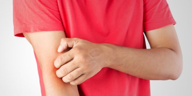 man in red tshirt scratching his inner elbow with opposite hand