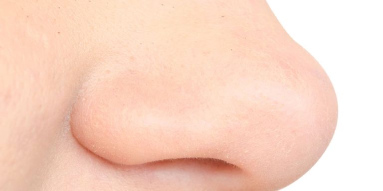 How to get rid of a blocked nose - Blocked and stuffy nose treatments with homeopathy